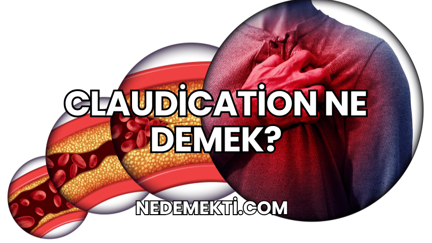 Claudication Ne Demek?