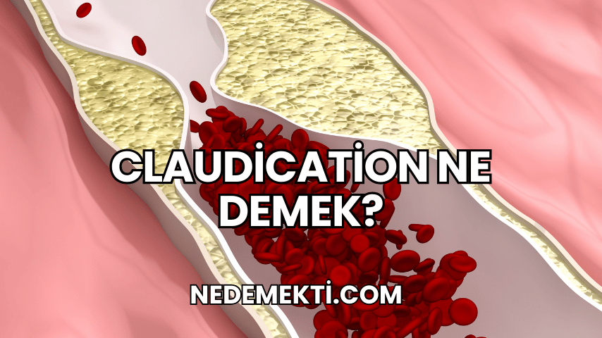 Claudication Ne Demek?